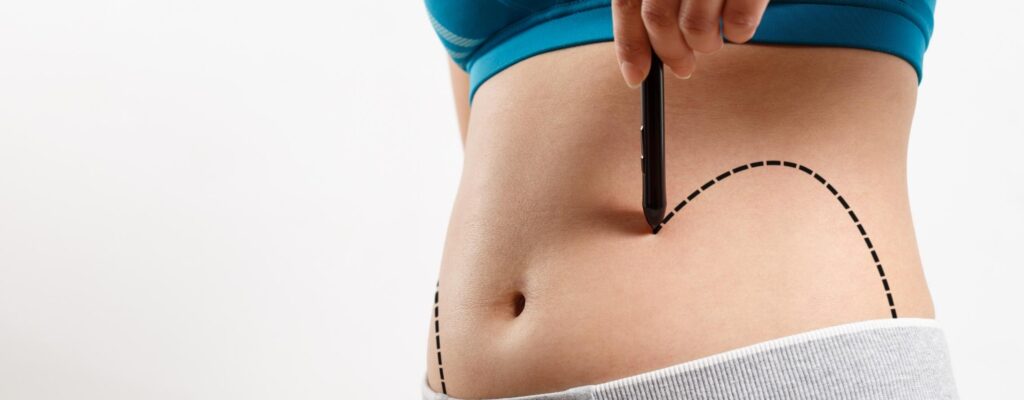 mommy makeover surgery overview