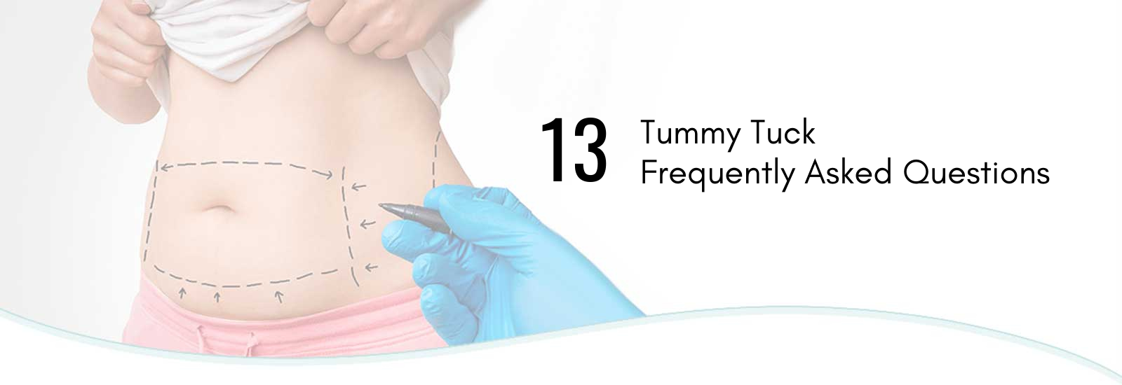 tummy tuck faq