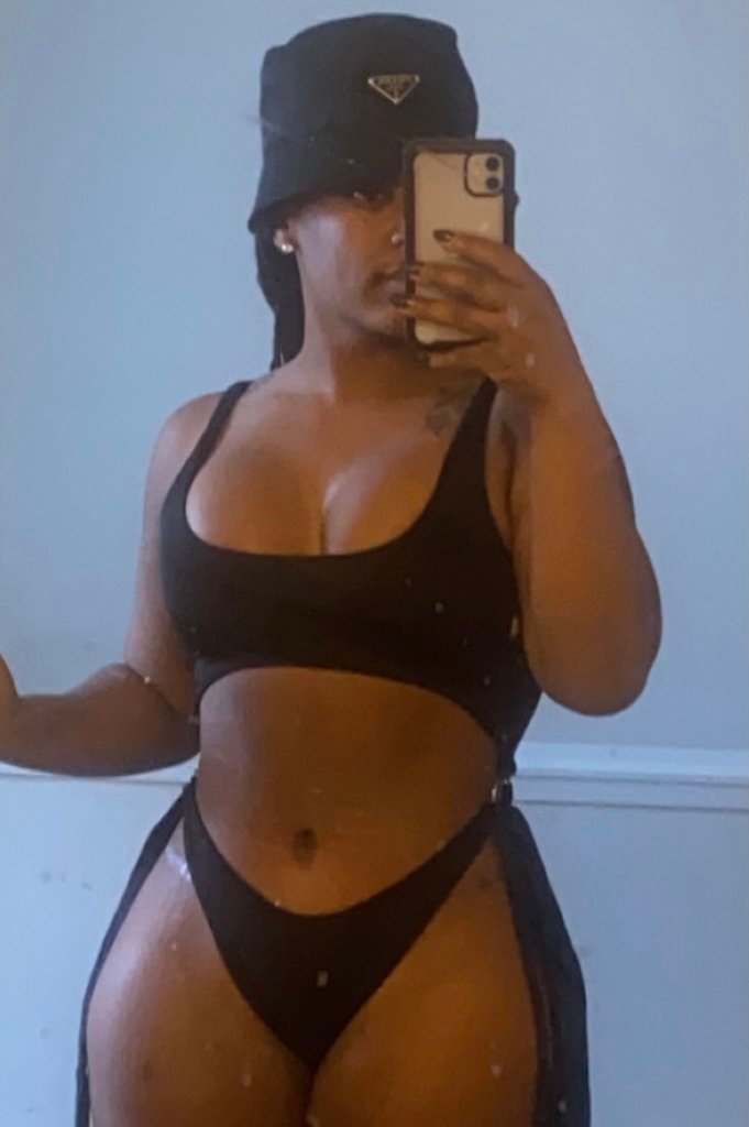 tummy tuck 1