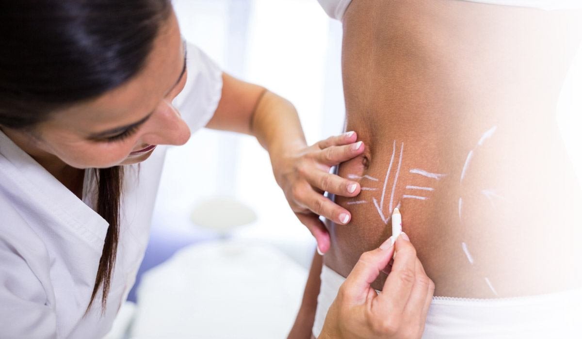 liposuction cost in Miami