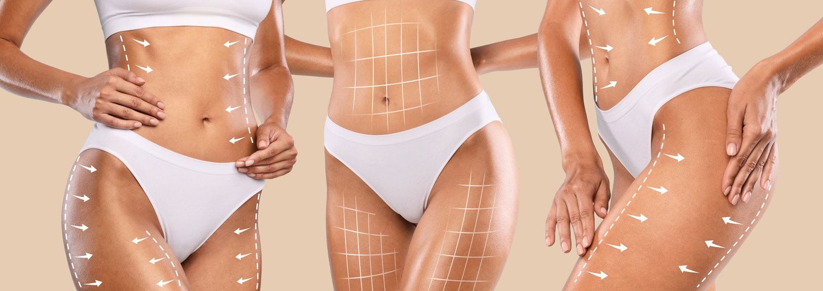 liposuction information