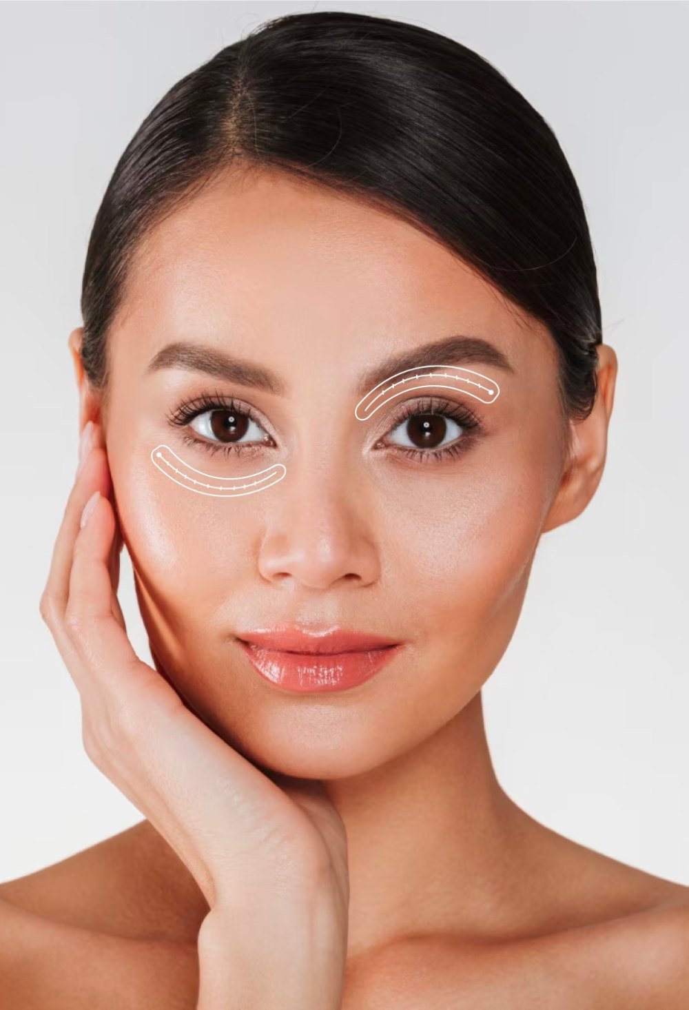 Blepharoplasty patient model miami