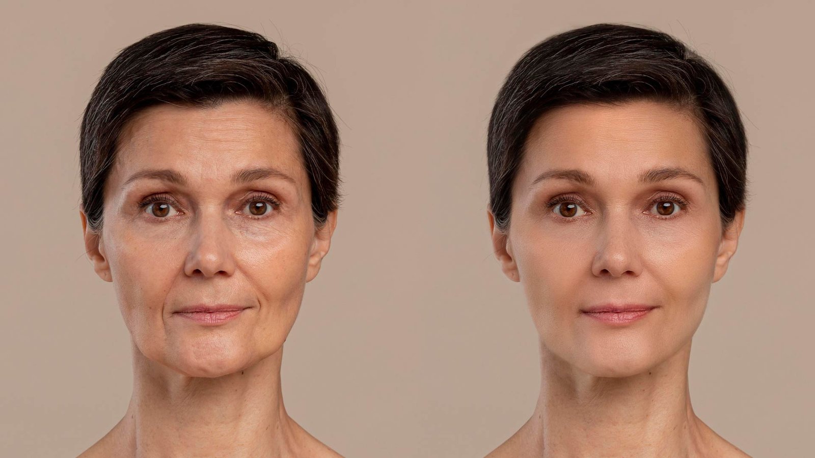 before after facial plastic surgery