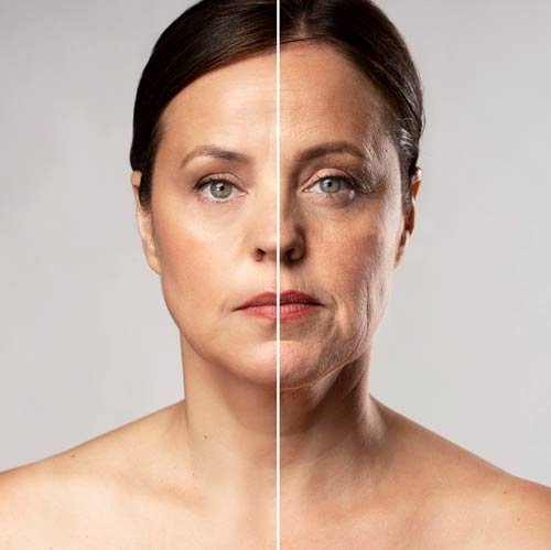 Face Surgery Miami example