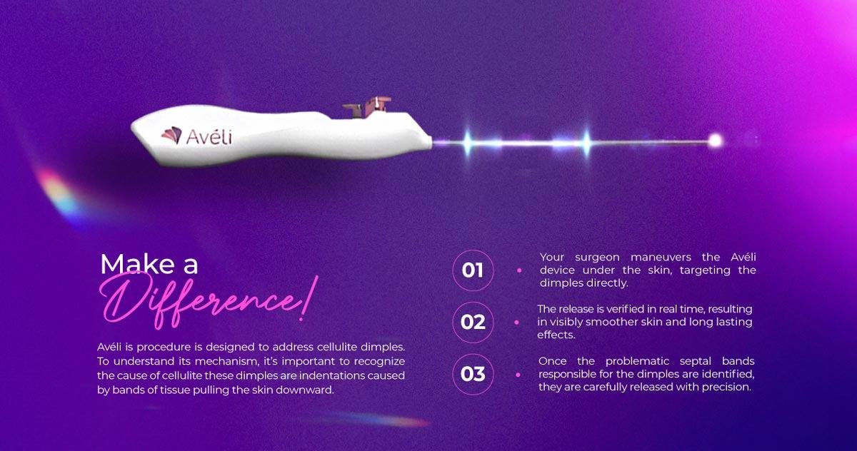 Aveli Cellulite Treatment