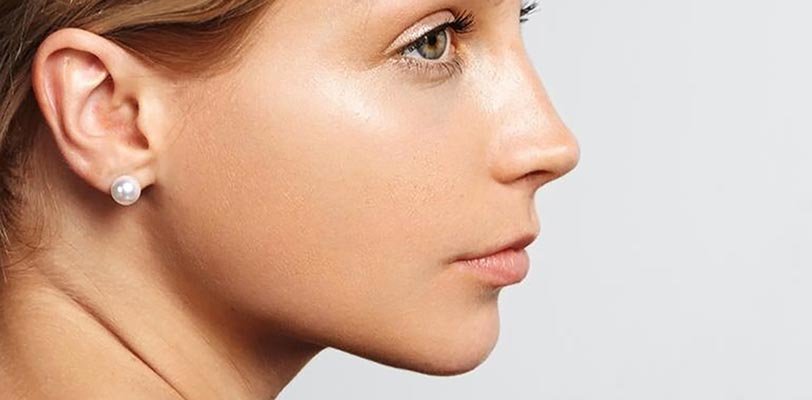 Rhinoplasty miami