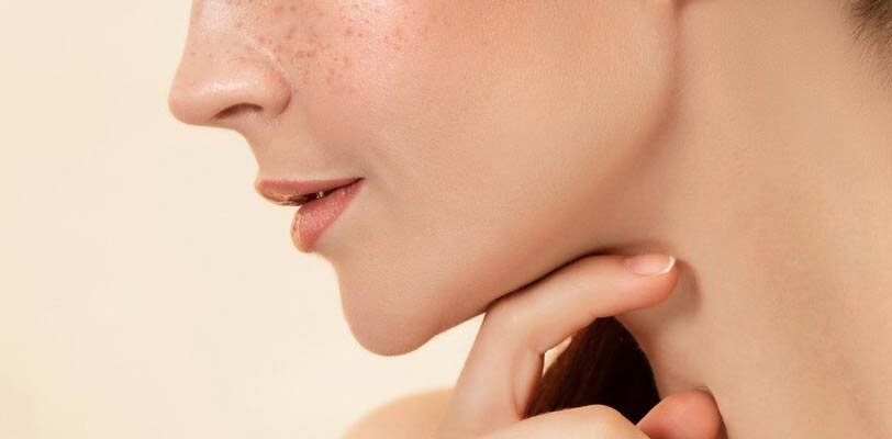 Miami chin lipo