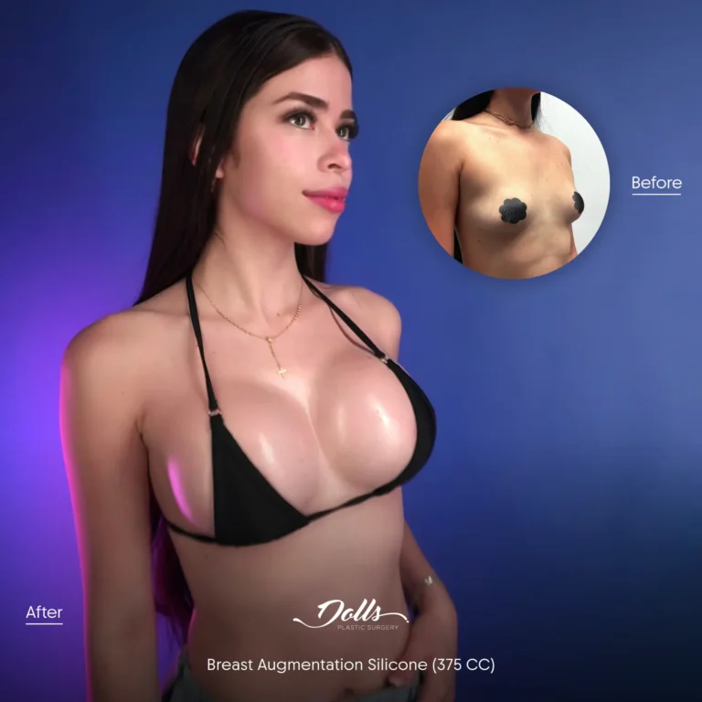 BAM-Silicone-Berman 3