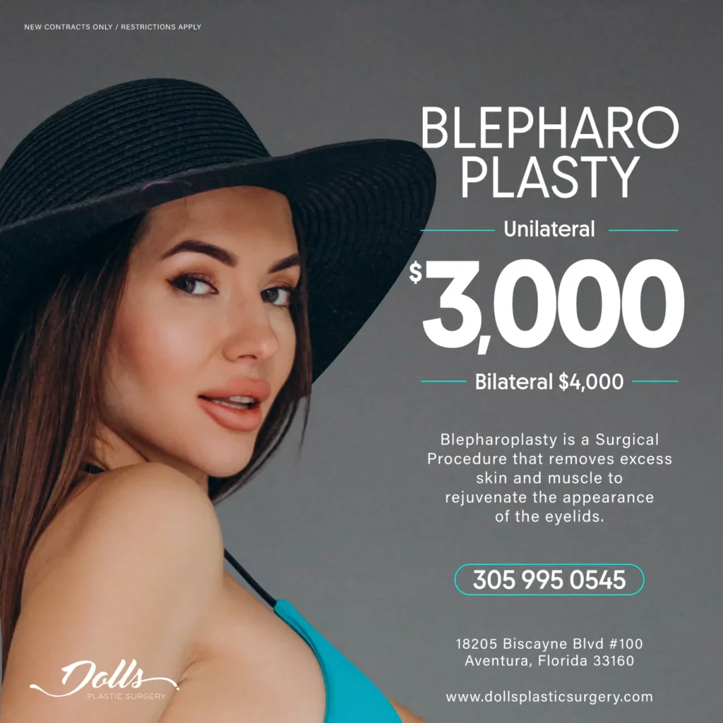 Summer_Blepharoplast_Post