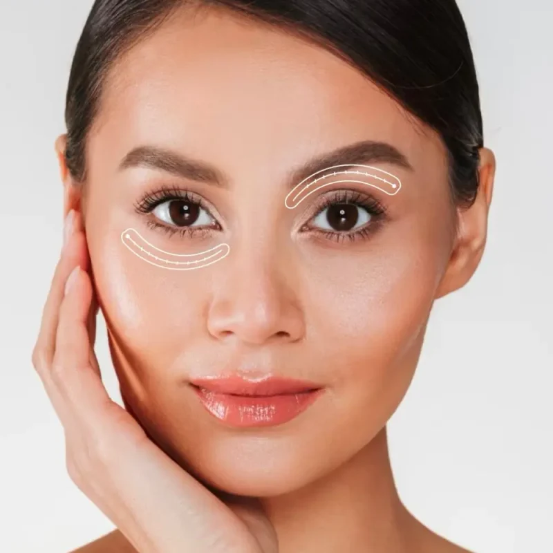 Blepharoplasty-01