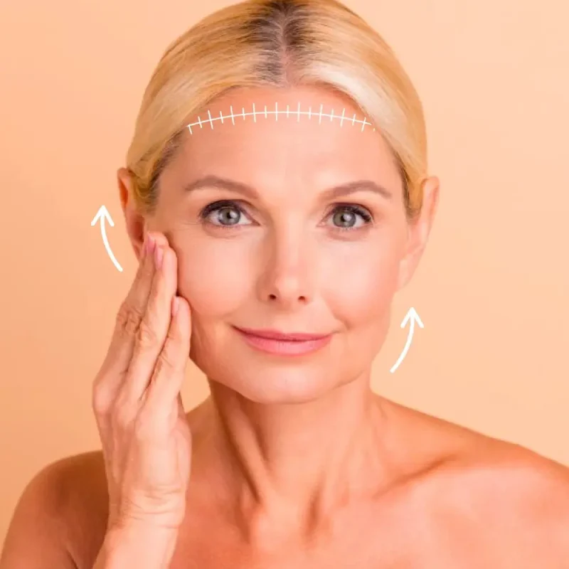 Face-Lift-01