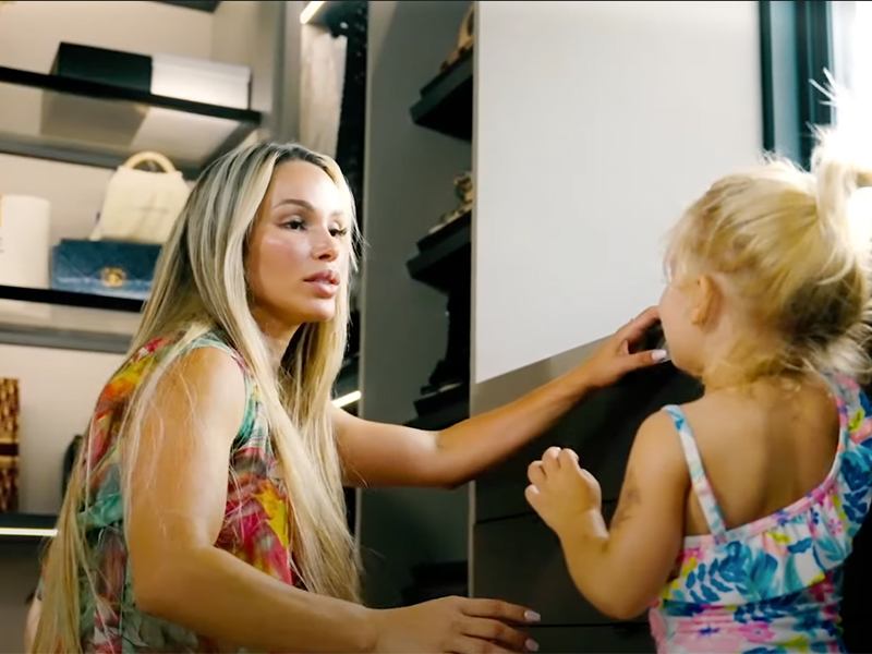 Tummy Tuck in Miami: The Destination Where Motherhood and Aesthetics Converge. Tummy tuck