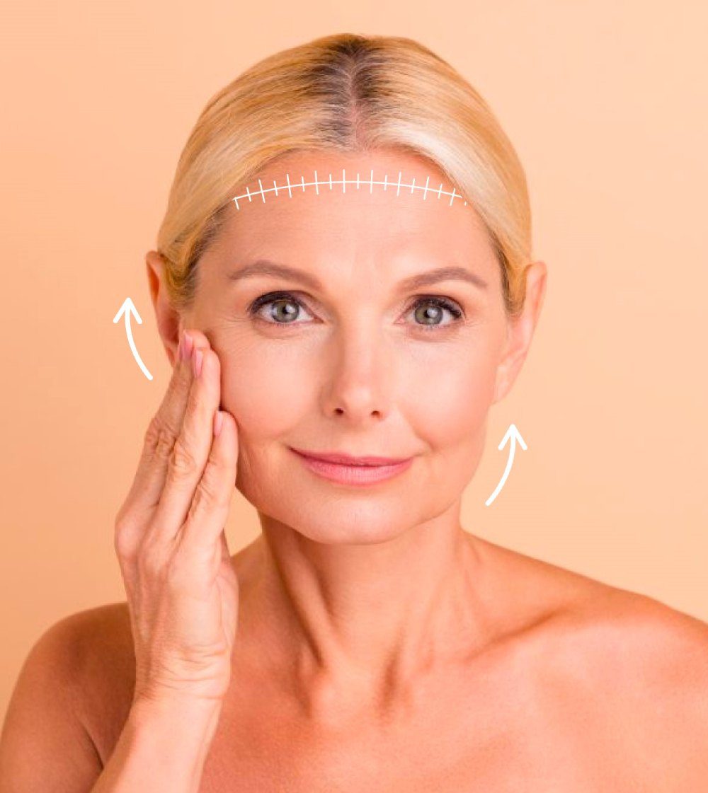 Facelift Miami Face Lift miami