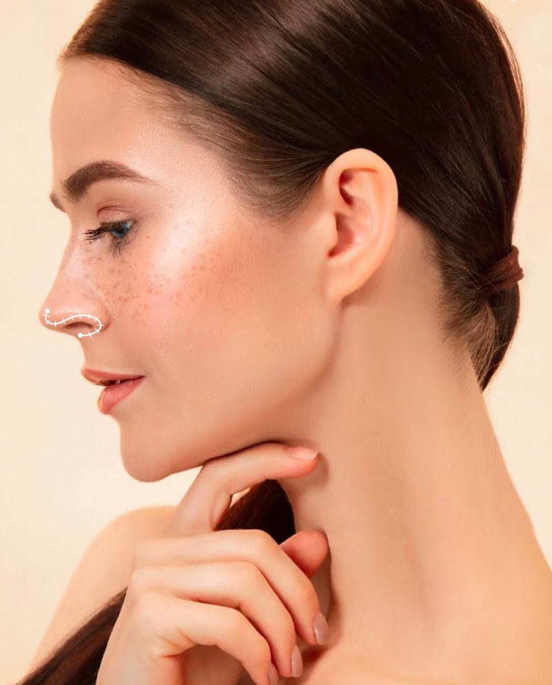 Rhinoplasty Miami Rhinoplasty nose job miami